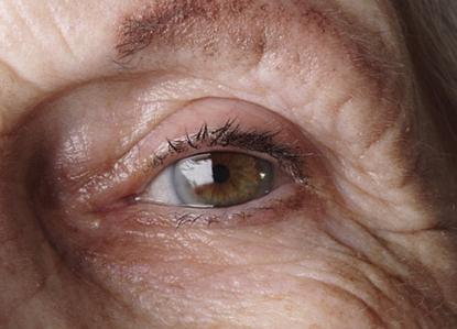 战“疫”时期，中老年眼健康怎么护理?