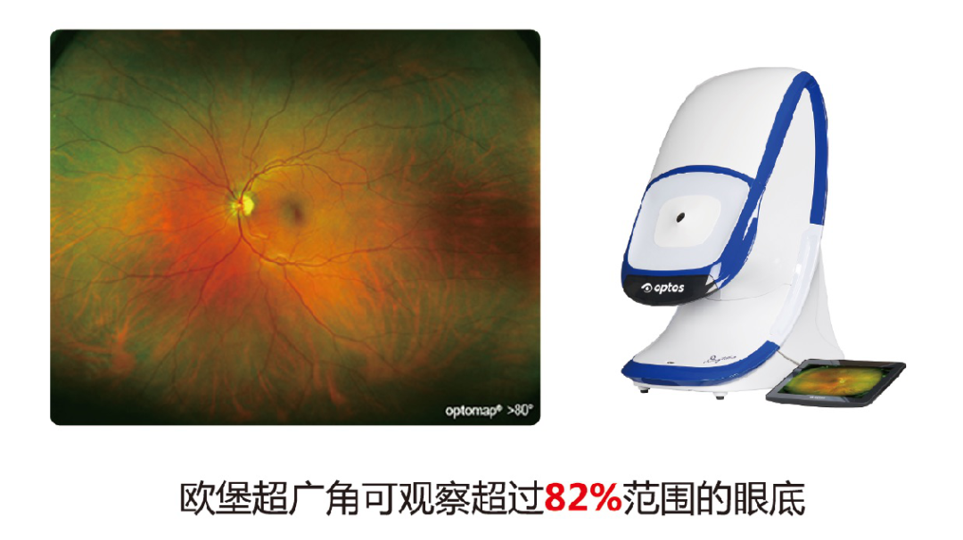 又快又准还免散瞳的眼底检查神器——欧堡